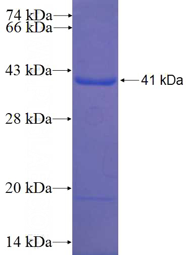 Recombinant Human CACHD1 SDS-PAGE