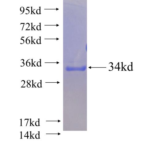 Recombinant human LPAR5 SDS-PAGE