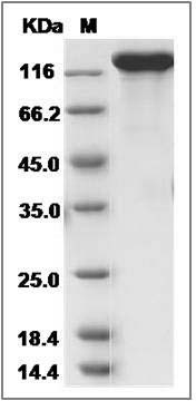 Rat Contactin 3 / CNTN3 Protein (His Tag) SDS-PAGE