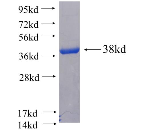 Recombinant human TXNL1 SDS-PAGE