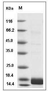 Human ALK-2 / ACVR1 / ALK2 Protein (His Tag) SDS-PAGE