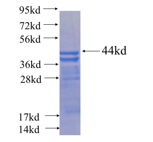 Recombinant human CCIN SDS-PAGE