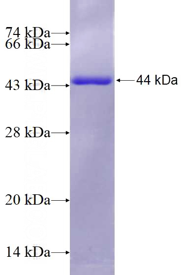 Recombinant Human PSMC2 SDS-PAGE