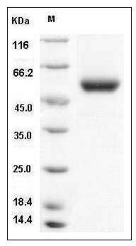Mouse Carboxypeptidase M / CPM Protein (His Tag) SDS-PAGE