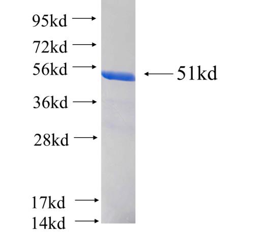 Recombinant human SNRPB2 SDS-PAGE