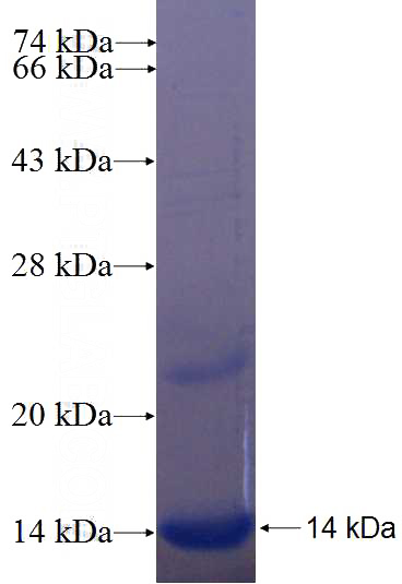 Recombinant Human SLC25A17 SDS-PAGE