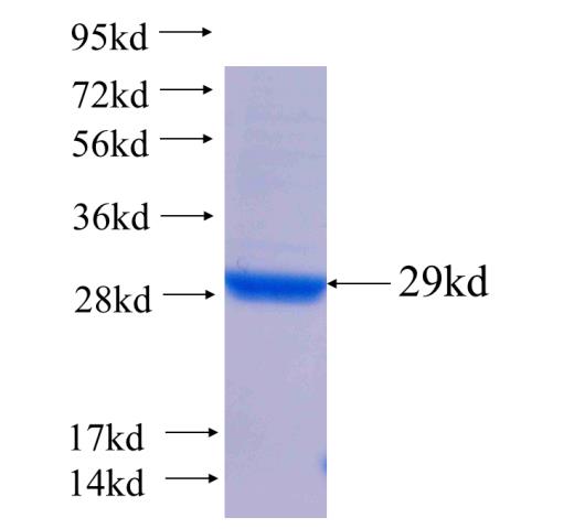 Recombinant human CCNJL SDS-PAGE