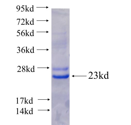 Recombinant human ZAP70 SDS-PAGE