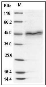 Human Follistatin / FST (FS288) Protein (His Tag) SDS-PAGE