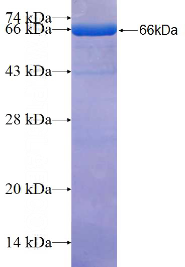 Recombinant Human FLJ11506 SDS-PAGE