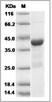 Human AARSD1 Protein (His Tag) SDS-PAGE