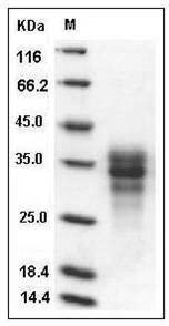 Human FAS / CD95 / APO-1 / TNFRSF6 Protein (His Tag) SDS-PAGE