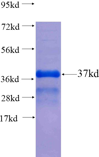Recombinant Human BRAP SDS-PAGE