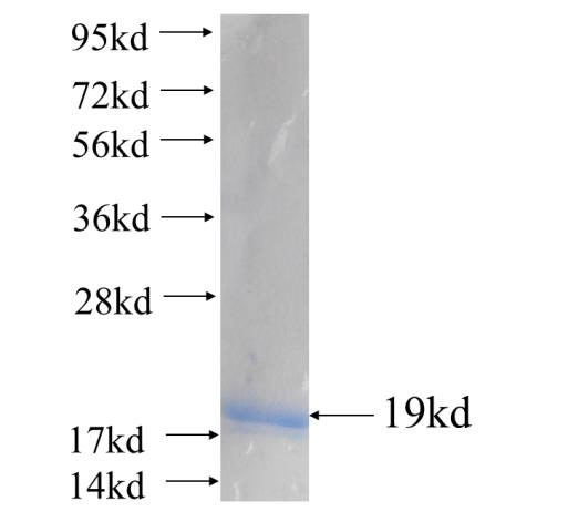 Recombinant human YIPF4 SDS-PAGE