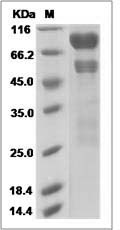 Human ITIH3 Protein (His Tag) SDS-PAGE