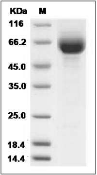 Human ILT6 / LILRA3 Protein (His Tag) SDS-PAGE