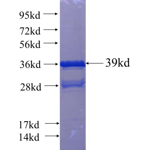 Recombinant human AFAP1L1 SDS-PAGE