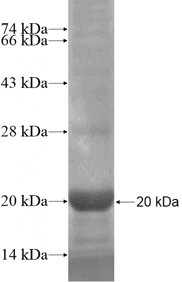 Recombinant Human GKN2 SDS-PAGE