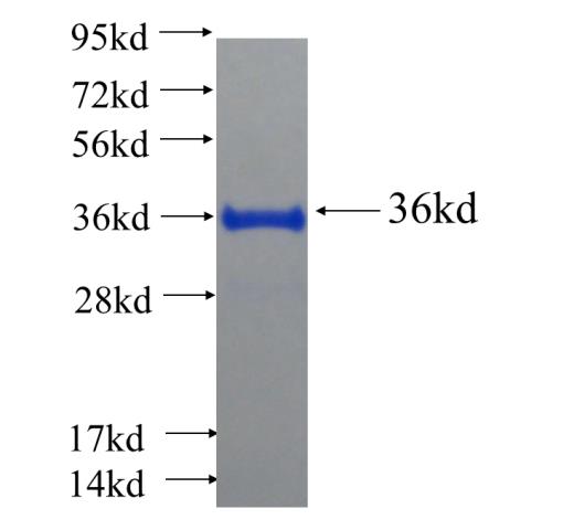 Recombinant human FOXRED1 SDS-PAGE