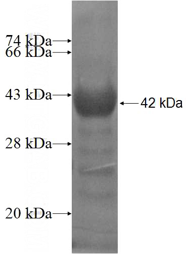 Recombinant Human STARD8 SDS-PAGE