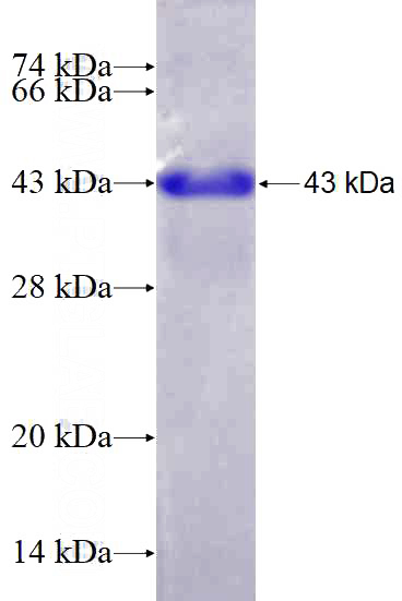 Recombinant Human LDOC1 SDS-PAGE