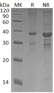 Human ASXL1/KIAA0978 (GST tag) recombinant protein