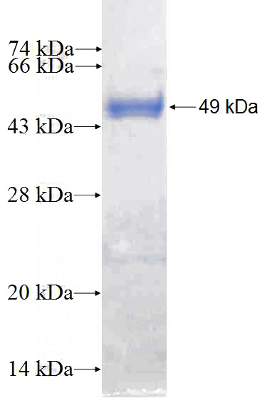 Recombinant Human RAB43 SDS-PAGE