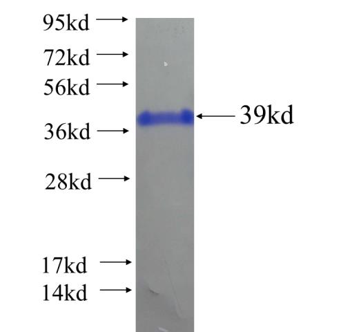 Recombinant human ARID4B SDS-PAGE