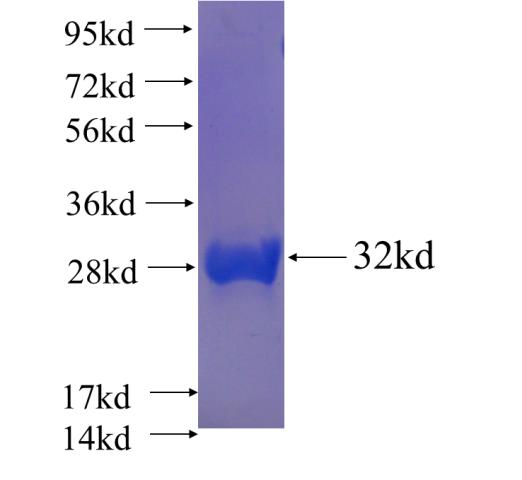 Recombinant human HOXA13 SDS-PAGE