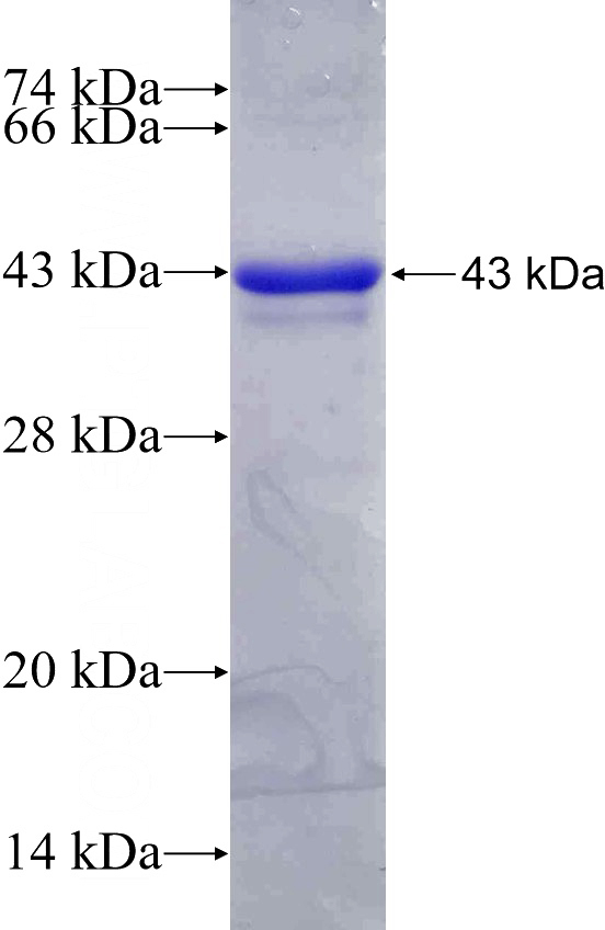 Recombinant Human RNF160 SDS-PAGE