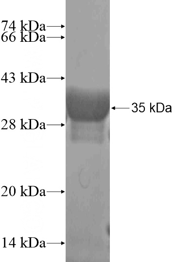 Recombinant Human C11orf31 SDS-PAGE