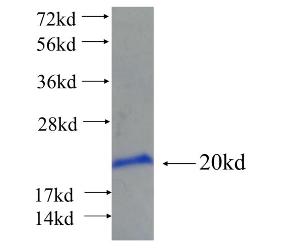 Recombinant human ZNF549 SDS-PAGE