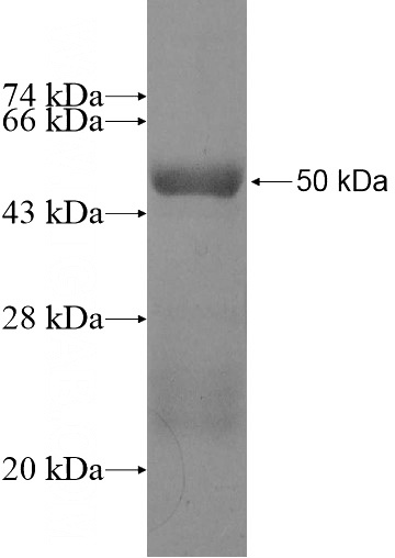Recombinant Human TADA2B SDS-PAGE