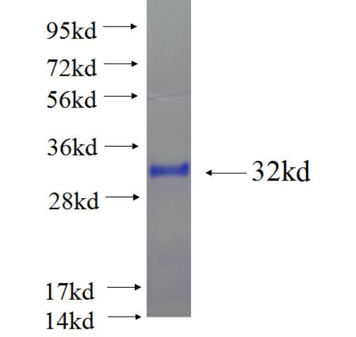 Recombinant human BTG2 SDS-PAGE