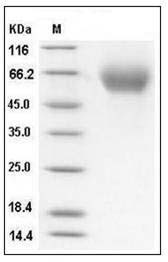 Human IL13RA1 Protein (His Tag) SDS-PAGE