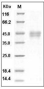 Human DKK1 / Dkk-1 Protein (His Tag) SDS-PAGE