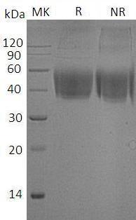 Mouse Cd80/B7 (His tag) recombinant protein