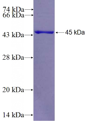 Recombinant Human LGALS4,GAL4 SDS-PAGE