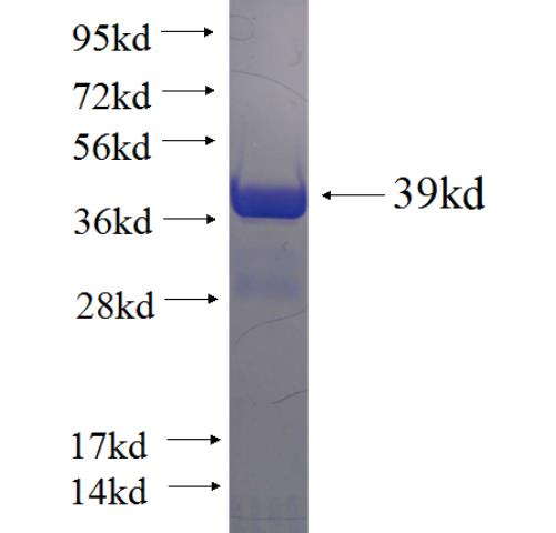 Recombinant human AQP4 SDS-PAGE