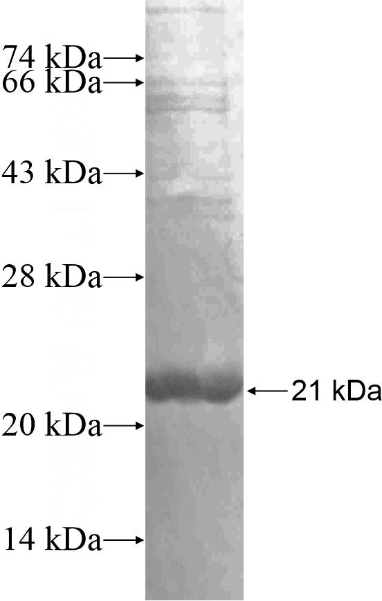 Recombinant Human PYCR1 SDS-PAGE