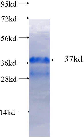 Recombinant Human ROS1 SDS-PAGE
