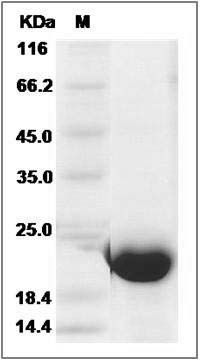 Human CFL1 / N-cofilin Protein (His Tag) SDS-PAGE