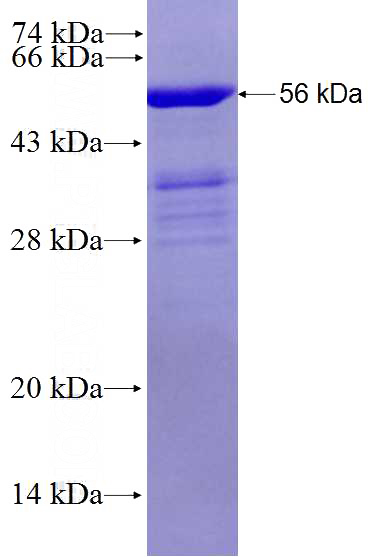Recombinant Human TTC12 SDS-PAGE