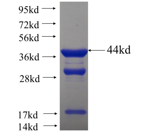 Recombinant human DOCK6 SDS-PAGE
