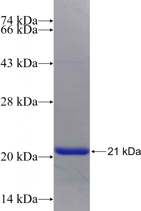 Recombinant Human GEMIN6 SDS-PAGE