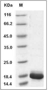 Human IL36G / IL1F9 Protein (aa 18-169, His Tag) SDS-PAGE