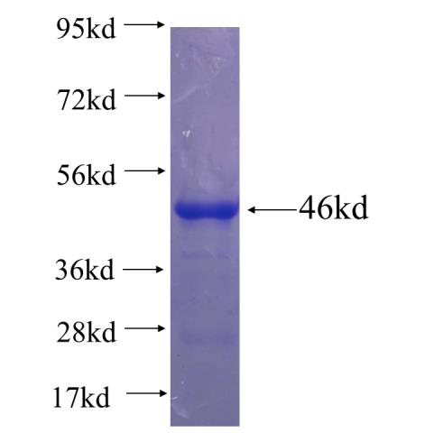 Recombinant human CXCL16 SDS-PAGE