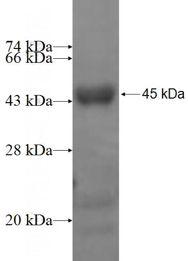 Recombinant Human AGAP1,CENTG2 SDS-PAGE