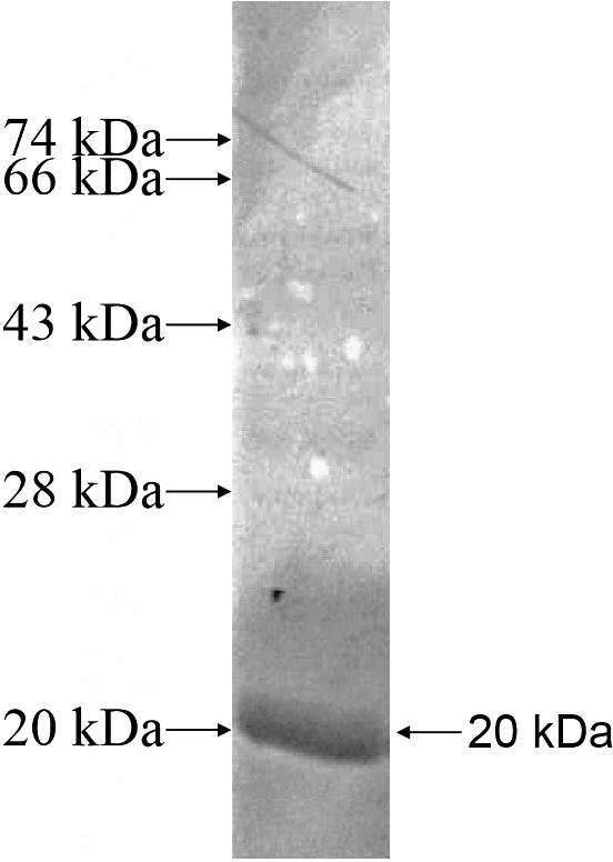 Recombinant Human KCNAB3 SDS-PAGE