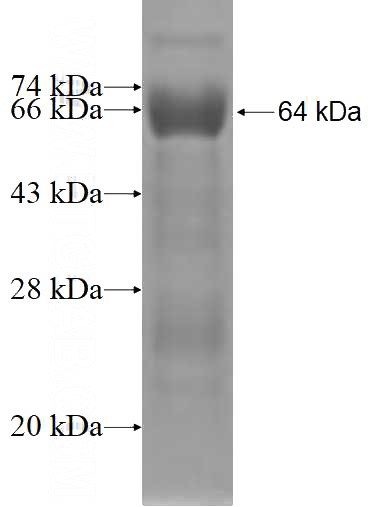 Recombinant Human ALS2CR8 SDS-PAGE